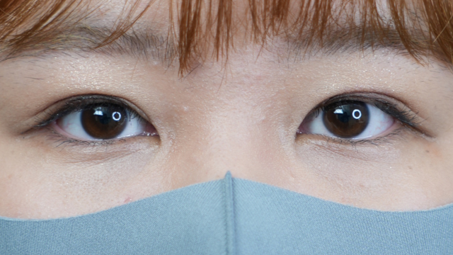 手术前的状态 其一