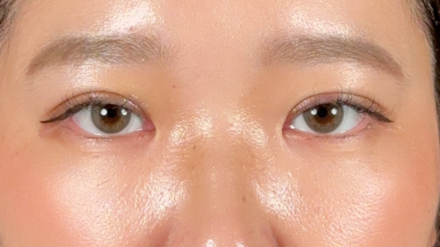 手术前的状态 其一