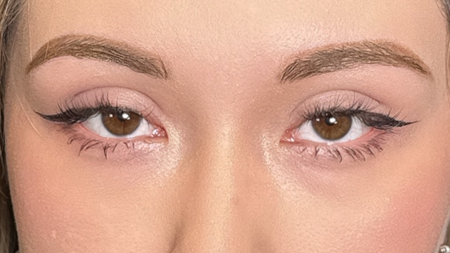 手术前的状态 其一