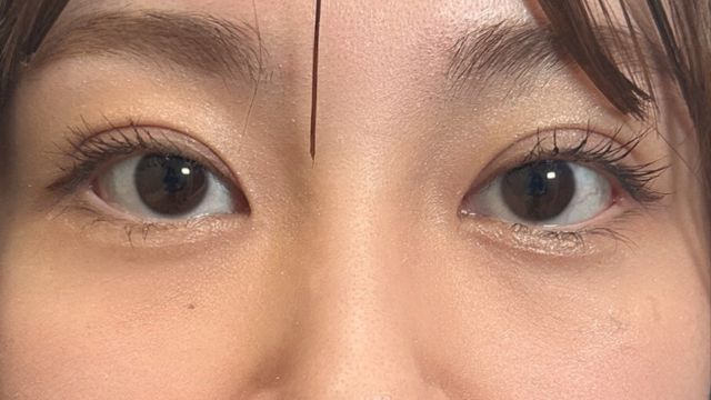 手术前的状态 其一