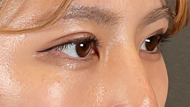 手術前の状態 その1