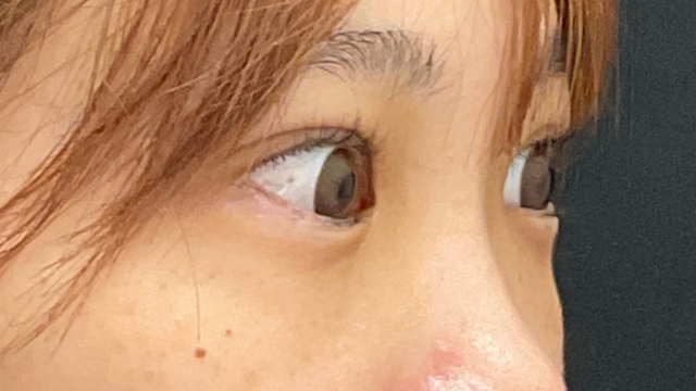 手术前的状态 其一