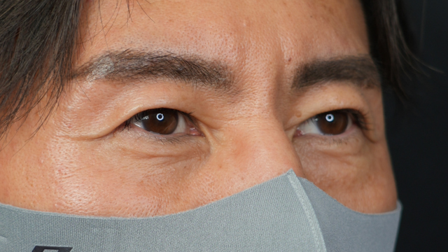 手术前的状态 其一