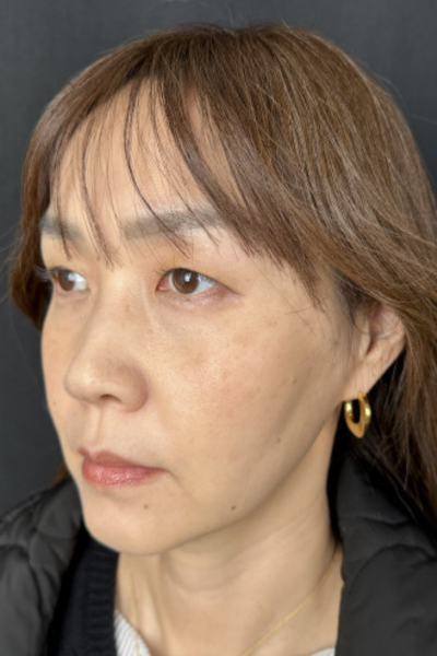 手術前の状態 その1