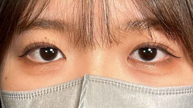 手术前的状态 其一