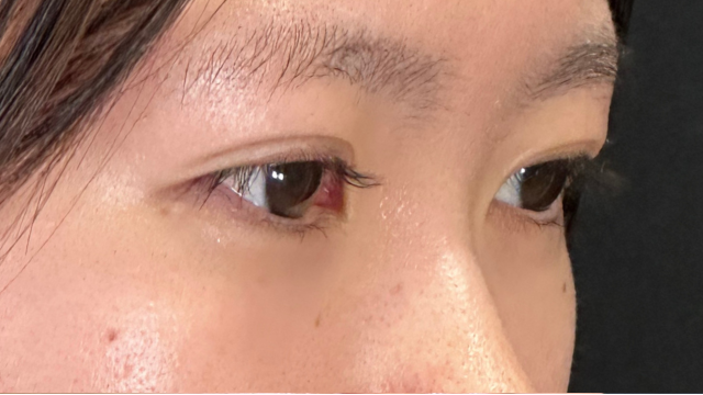 手术前的状态 其一