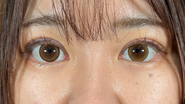 手术前的状态 其一