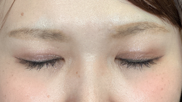 Postoperative Condition Part 1