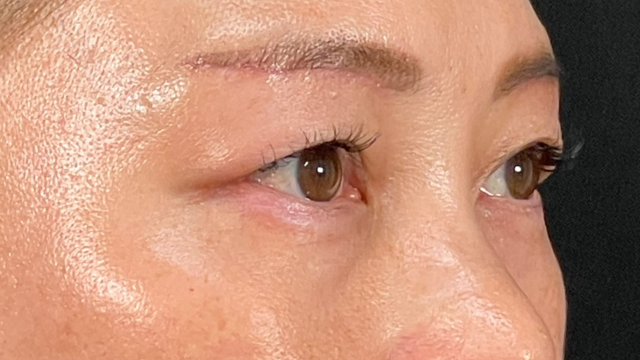 Postoperative Condition Part 1