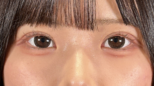 手術前の状態 その1