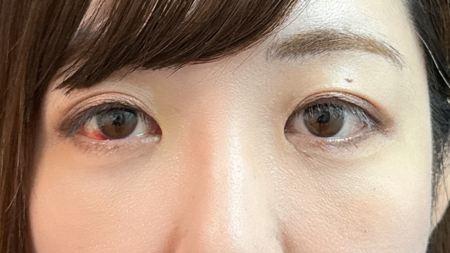 手术前的状态 其一