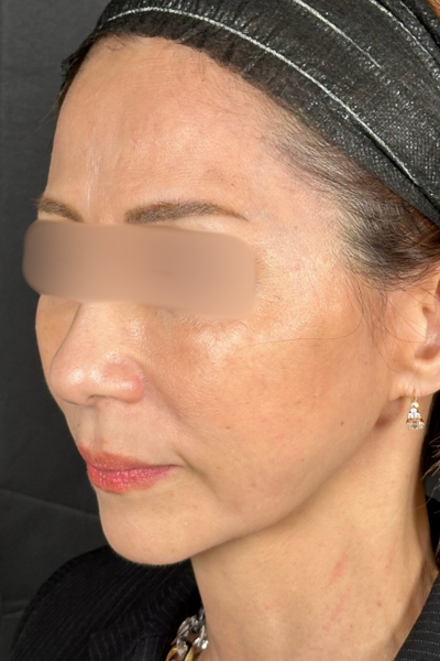 手術前の状態 その1