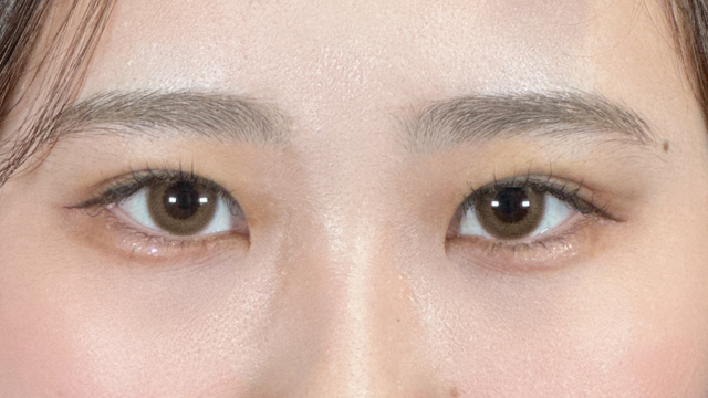 手术前的状态 其一