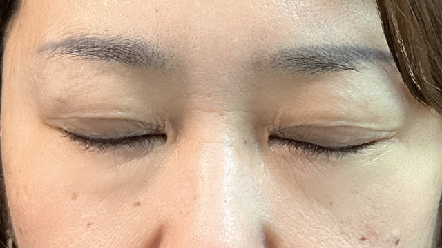 Postoperative Condition Part 1