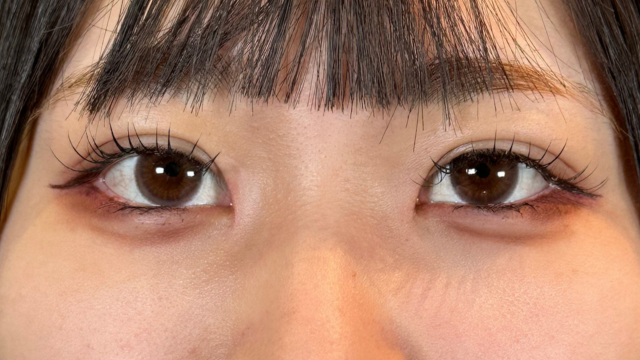 手術前の状態 その1