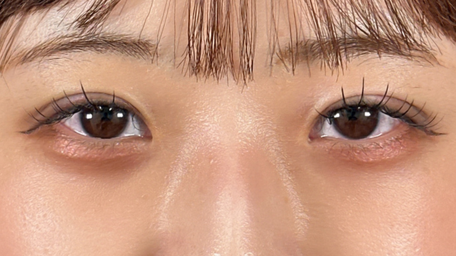 手术前的状态 其一