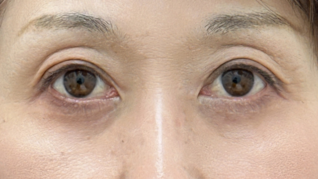 手术前的状态 其一