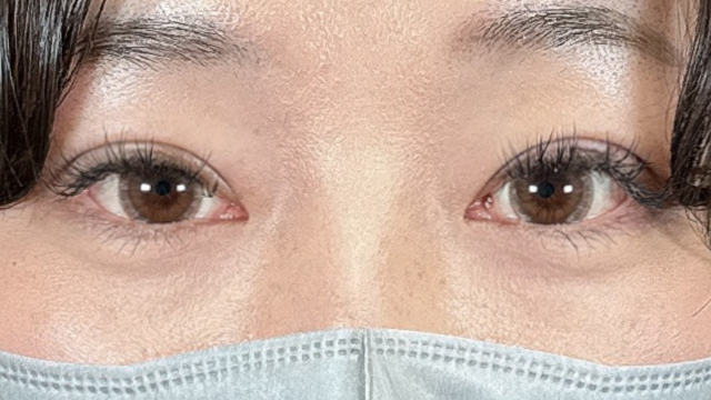 手术前的状态 其一