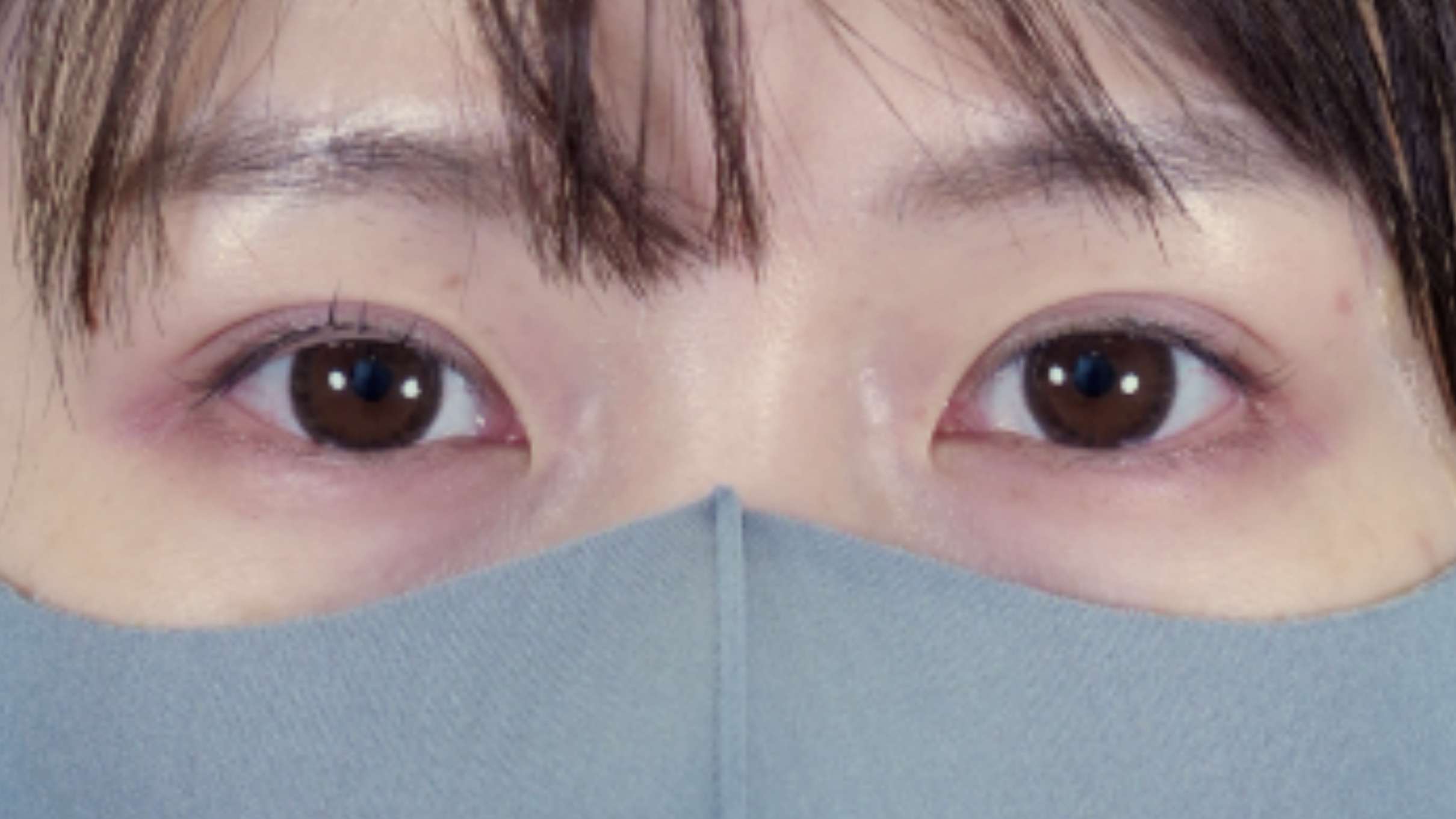 手术前的状态 其一