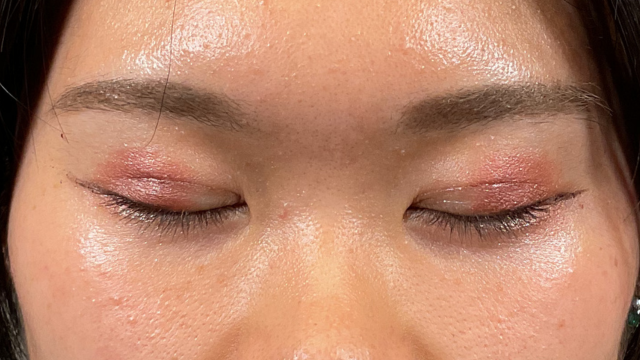 手术前的状态 其一