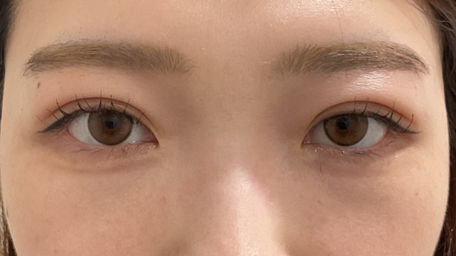 Postoperative Condition Part 1