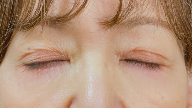 Postoperative Condition Part 1