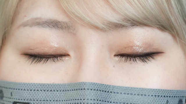 手术前的状态 其一