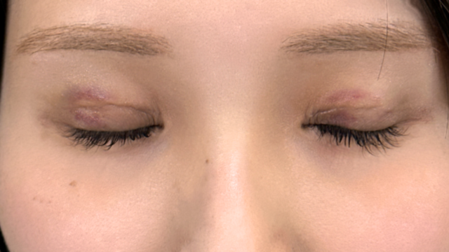 手术前的状态 其一