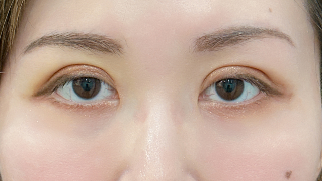 Postoperative Condition Part 1