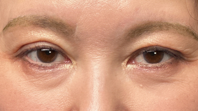 手术前的状态 其一