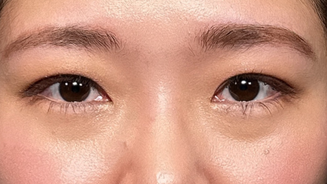 手术前的状态 其一