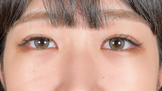 手术前的状态 其一