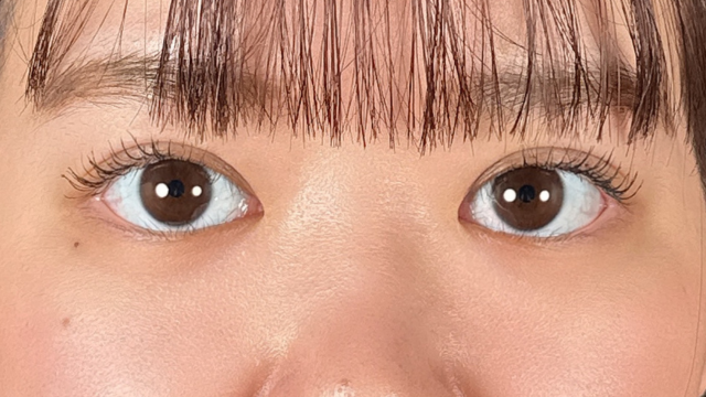 手术前的状态 其一