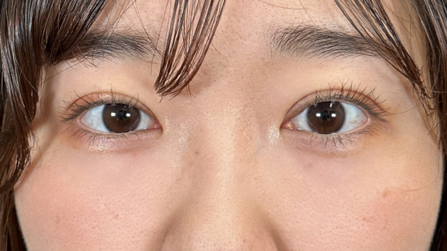 Postoperative Condition Part 1