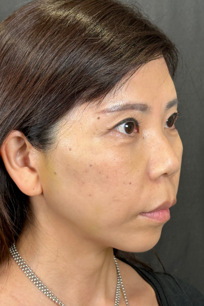 手术前的状态 其一