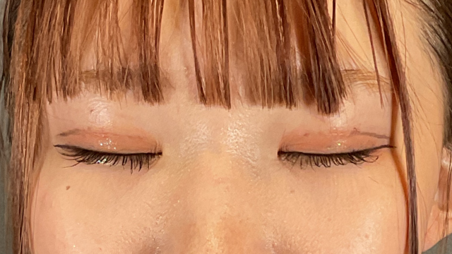 手術前の状態 その1