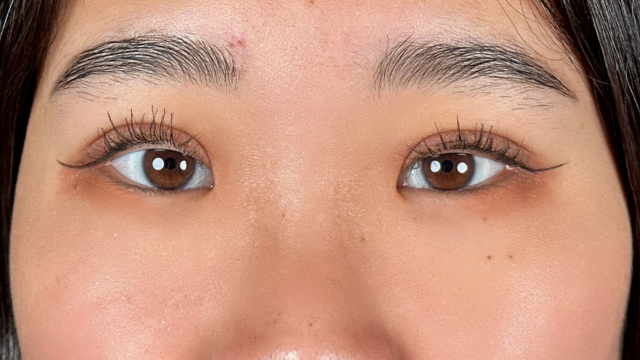 手术前的状态 其一