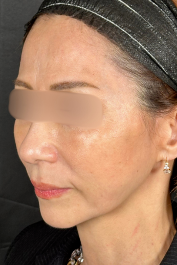 手術前の状態 その1