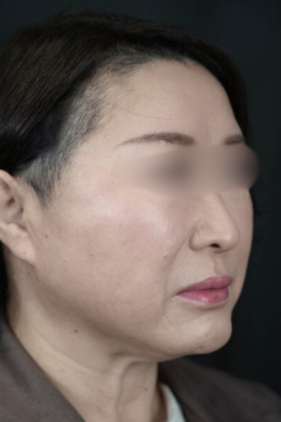 Postoperative Condition Part 1