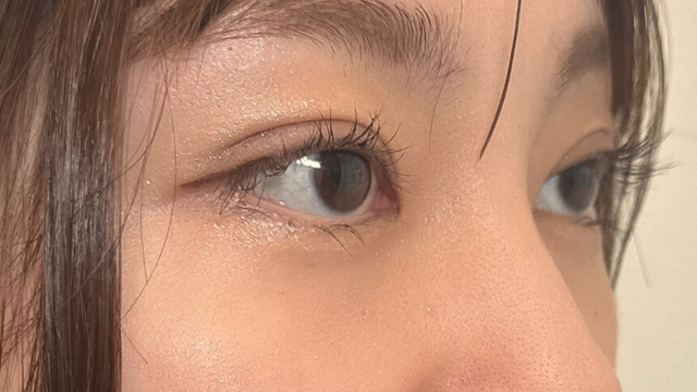 手术前的状态 其一