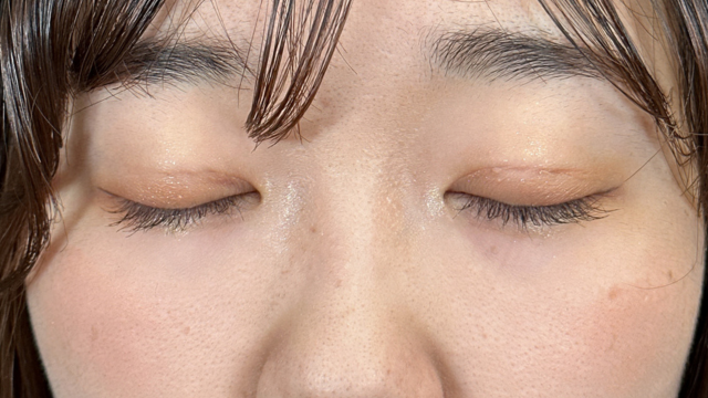 Postoperative Condition Part 1