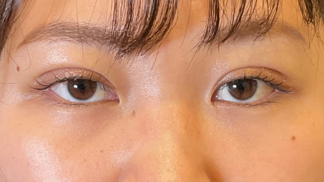 Postoperative Condition Part 1