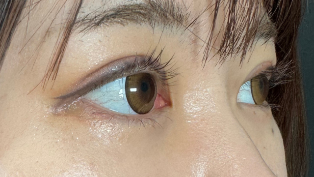 手术前的状态 其一