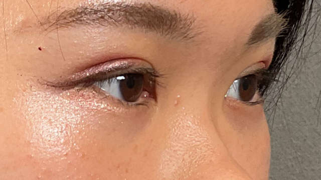 手术前的状态 其一