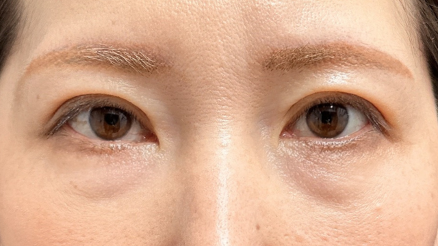 Postoperative Condition Part 1