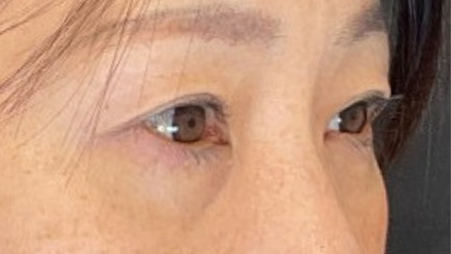 手术前的状态 其一