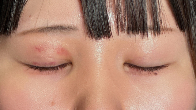 Postoperative Condition Part 1