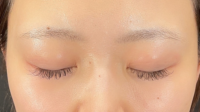 手术前的状态 其一