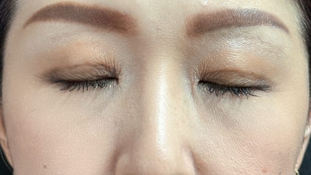 Postoperative Condition Part 1