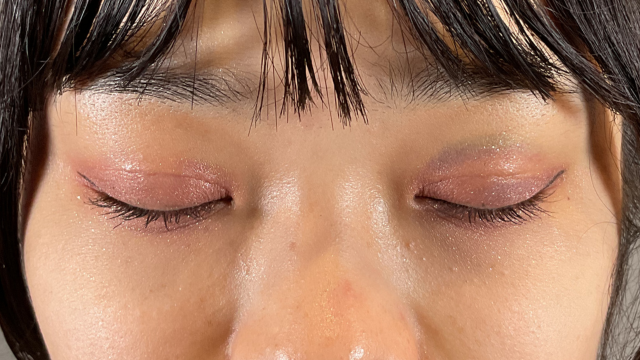 手术前的状态 其一